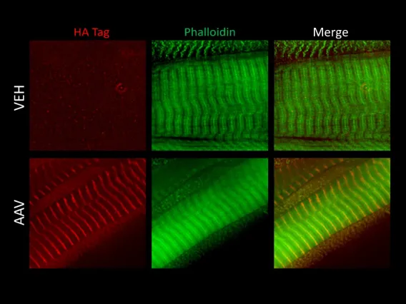 Z-disc nebulin fragment AAV with HA tag