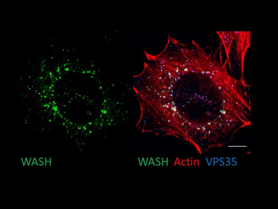 IF staining of endosomal GFP-WASH
