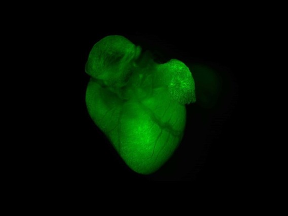 AAV-GFP expression in mouse heart